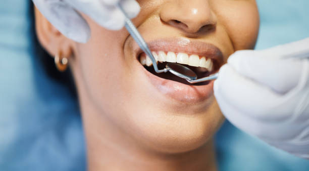 Best Knocked-Out Tooth Emergency  in Pelham, AL